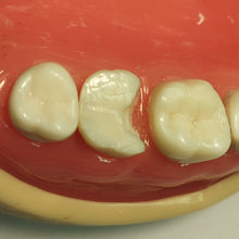 Load image into Gallery viewer, Rhondium DME Wedges - Assorted, 100 pack