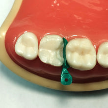 Load image into Gallery viewer, Rhondium DME Wedges - Assorted, 100 pack