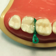 Load image into Gallery viewer, Rhondium DME Wedges - Assorted, 100 pack