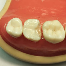 Load image into Gallery viewer, Rhondium DME Wedges - Assorted, 100 pack